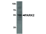 PARK2 Antibody in Western Blot (WB)