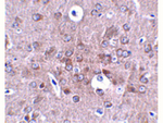 PCDH18 Antibody in Immunohistochemistry (Paraffin) (IHC (P))