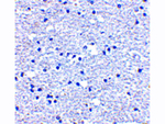 PD-1 Polyclonal Antibody