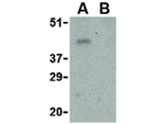 PD-1 Antibody in Western Blot (WB)