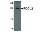 PDCL2 Polyclonal Antibody