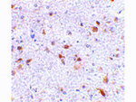 PDL2 Antibody in Immunohistochemistry (Paraffin) (IHC (P))