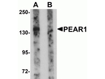 PEAR1 Antibody in Western Blot (WB)