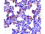 PEN2 Antibody in Immunohistochemistry (Paraffin) (IHC (P))