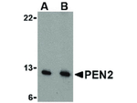 PEN2 Antibody in Western Blot (WB)