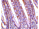 PHAP Antibody in Immunohistochemistry (Paraffin) (IHC (P))