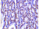 PHAP I Antibody in Immunohistochemistry (Paraffin) (IHC (P))