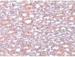 PIAS1 Antibody in Immunohistochemistry (Paraffin) (IHC (P))