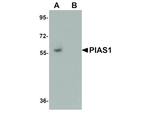 PIAS1 Antibody in Western Blot (WB)