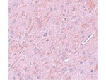 PIAS2 Antibody in Immunohistochemistry (Paraffin) (IHC (P))