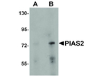 PIAS2 Antibody in Western Blot (WB)