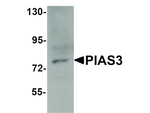 PIAS3 Antibody in Western Blot (WB)