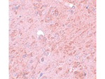 PIAS4 Antibody in Immunohistochemistry (Paraffin) (IHC (P))