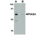 PIAS4 Antibody in Western Blot (WB)
