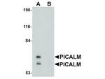 PICALM Antibody in Western Blot (WB)