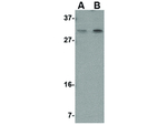 PIG-Y Antibody in Western Blot (WB)