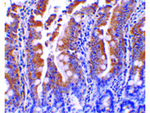 PIST Antibody in Immunohistochemistry (Paraffin) (IHC (P))