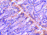 PIST Antibody in Immunohistochemistry (Paraffin) (IHC (P))