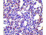PKR Antibody in Immunohistochemistry (Paraffin) (IHC (P))