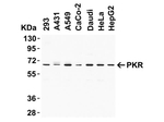 PKR Antibody in Western Blot (WB)