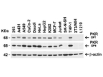 PKR Antibody in Western Blot (WB)