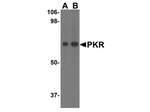 PKR Antibody in Western Blot (WB)