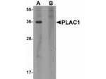 PLAC1 Antibody in Western Blot (WB)