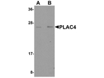 PLAC4 Antibody in Western Blot (WB)