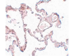 PLEKHM1 Antibody in Immunohistochemistry (Paraffin) (IHC (P))