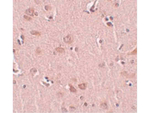 PLEKHM2 Antibody in Immunohistochemistry (Paraffin) (IHC (P))