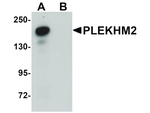PLEKHM2 Antibody in Western Blot (WB)