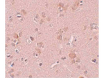 PLEKHM3 Antibody in Immunohistochemistry (Paraffin) (IHC (P))