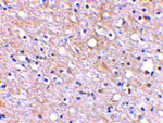PLXDC2 Antibody in Immunohistochemistry (Paraffin) (IHC (P))