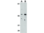 PLXDC2 Antibody in Western Blot (WB)