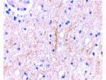 PLXDC2 Antibody in Immunohistochemistry (Paraffin) (IHC (P))