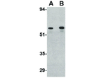 PLXDC2 Antibody in Western Blot (WB)