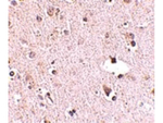 POLR3F Antibody in Immunohistochemistry (Paraffin) (IHC (P))
