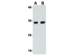 POLR3F Antibody in Western Blot (WB)