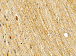 POU2F3 Antibody in Immunohistochemistry (Paraffin) (IHC (P))