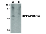 PPAPDC1A Antibody in Western Blot (WB)