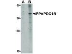 PPAPDC1B Polyclonal Antibody