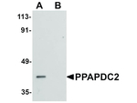 PPAPDC2 Antibody in Western Blot (WB)