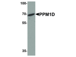 PPM1D Polyclonal Antibody
