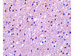 Presenilin1 Antibody in Immunohistochemistry (Paraffin) (IHC (P))