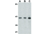 Presenilin1 Antibody in Western Blot (WB)