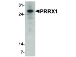 PRRX1 Polyclonal Antibody