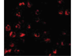 PUMA Polyclonal Antibody