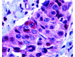 PUMA Antibody in Immunohistochemistry (Paraffin) (IHC (P))