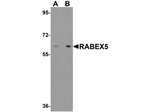 RABEX5 Antibody in Western Blot (WB)