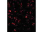 RAIDD Antibody in Immunocytochemistry (ICC/IF)
